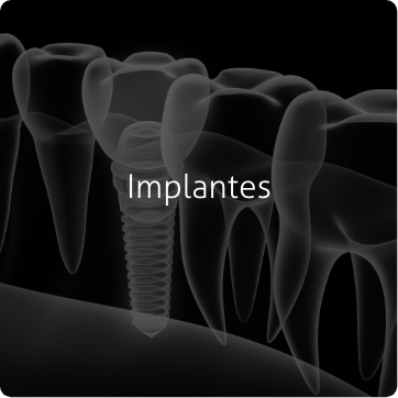 Implantes